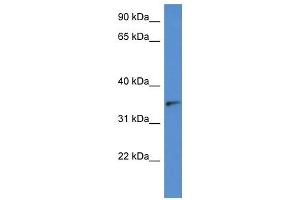Western Blot showing SORD antibody used at a concentration of 1 ug/ml against Hela Cell Lysate