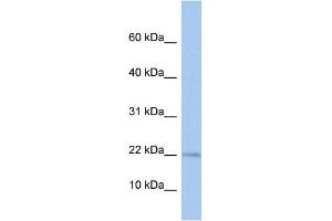 WB Suggested Anti-MPV17L Antibody Titration: 0.