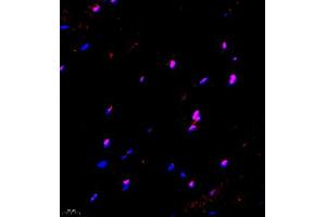 Immunofluorescence of paraffin embedded mouse Skeletal muscle using ZNF498 (ABIN7076253) at dilution of 1:650 (400x lens) (Zinc Finger and SCAN Domain Containing 25 (ZSCAN25) antibody)
