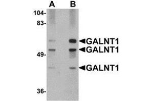 Western blot analysis of GALNT10 in rat brain tissue lysate with AP30352PU-N GALNT10 antibody at (A) 1 and (B) 2 μg/ml. (GALNT10 antibody  (N-Term))