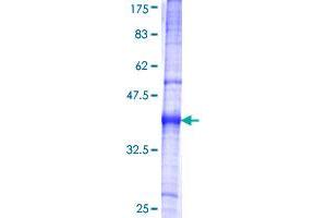 Corin Protein (AA 616-715) (GST tag)