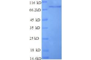 SDS-PAGE (SDS) image for Poly A Specific Ribonuclease (PARN) (AA 1-639), (full length) protein (His tag) (ABIN5710067) (PARN Protein (AA 1-639, full length) (His tag))
