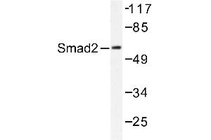 Image no. 1 for anti-SMAD, Mothers Against DPP Homolog 2 (SMAD2) antibody (ABIN271912) (SMAD2 antibody)