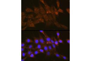 Immunofluorescence analysis of NIH-3T3 cells using OSBP Rabbit pAb (ABIN1681171, ABIN3018393, ABIN3018394 and ABIN6220458) at dilution of 1:100 (40x lens). (OSBP antibody  (AA 508-807))