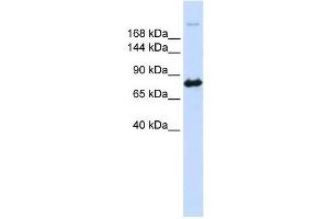 CAD antibody used at 1 ug/ml to detect target protein. (CAD antibody  (N-Term))