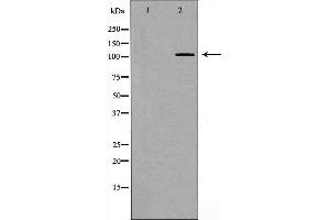 Western blot analysis of EPHB4 expression in 293 cell extract,The lane on the left is treated with the antigen-specific peptide.