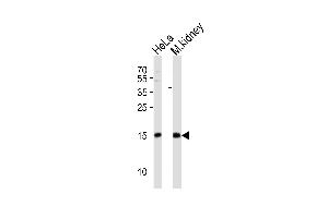Western blot analysis of lysates from HeLa cell line, mouse kidney tissue lysate (from left to right), using CDA Antibody (C-term) (ABIN389393 and ABIN2839485). (CDA antibody  (C-Term))