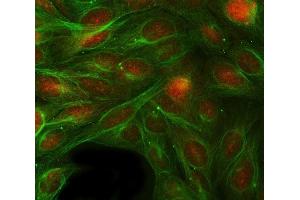 IF analysis of RBP1 using anti-RBP1 antibody (ABIN7599586) and anti-Tubulin Alpha antibody (ABIN7600339). (RBP1 antibody  (AA 10-135))