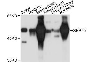 Western blot analysis of extracts of various cell lines, using SEPT5 antibody. (Septin 5 antibody)