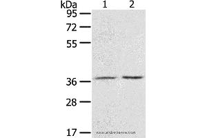 Western blot analysis of Mouse stomach tissue and A431 cell, using PDLIM4 Polyclonal Antibody at dilution of 1:800