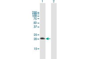 Western Blot analysis of RGS10 expression in transfected 293T cell line by RGS10 MaxPab polyclonal antibody. (RGS10 antibody  (AA 1-181))