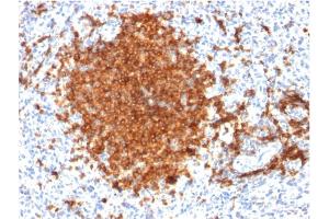 Formalin-fixed, paraffin-embedded human Spleen stained with CD22-Monospecific Mouse Monoclonal Antibody (BLCAM/1795). (CD22 antibody  (AA 52-178))