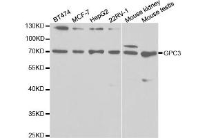 Western blot analysis of extracts of various cell lines, using GPC3 antibody (ABIN5971006) at 1/1000 dilution. (Glypican 3 antibody)