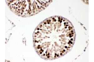 Anti- PBK Picoband antibody, IHC(P) IHC(P): Rat Testis Tissue (PBK antibody  (AA 71-322))