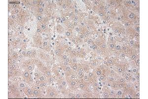 Immunohistochemical staining of paraffin-embedded liver tissue using anti-PROM2mouse monoclonal antibody. (Prominin 2 antibody)