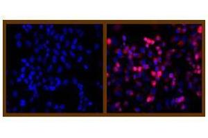 Immunofluorescence (IF) image for anti-His Tag antibody (ABIN126947) (His Tag antibody)