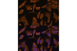 Immunofluorescence analysis of U-2 OS cells using MTMR4 Polyclonal Antibody (ABIN7268764) at dilution of 1:100 (40x lens). (MTMR4 antibody  (AA 920-1195))