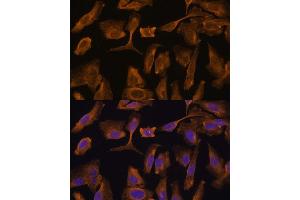 Immunofluorescence analysis of U-2 OS cells using MTMR4 Polyclonal Antibody (ABIN7268764) at dilution of 1:100 (40x lens).