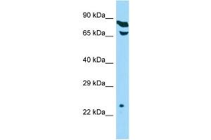 Host: Rabbit Target Name: THOC7 Sample Type: HepG2 Whole Cell lysates Antibody Dilution: 1.