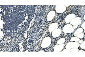 IHC analysis of LSM8 using anti-LSM8 antibody (ABIN7599579).