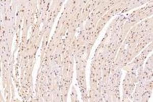 Immunohistochemistry (Paraffin-embedded Sections) (IHC (p)) image for anti-Sad1 and UNC84 Domain Containing 2 (SUN2) antibody (ABIN7075502)