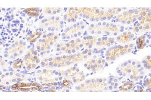 Detection of CK13 in Human Kidney Tissue using Polyclonal Antibody to Cytokeratin 13 (CK13)