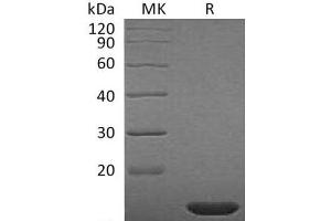 Western Blotting (WB) image for Fibroblast Growth Factor 2 (Basic) (FGF2) (Active) protein (ABIN7321251) (FGF2 Protein)