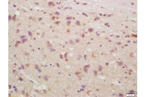 Formalin-fixed and paraffin embedded rat brain labeled with Anti-CHRM4/mAChR M4 Polyclonal Antibody, Unconjugated (ABIN1387838) at 1:200, followed by conjugation to the secondary antibody and DAB staining (CHRM4 antibody  (AA 1-31))