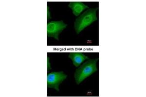 ICC/IF Image Immunofluorescence analysis of paraformaldehyde-fixed HeLa, using Annexin A1, antibody at 1:200 dilution. (Annexin a1 antibody)