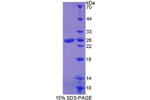 ABCA8 Protein (AA 1263-1456) (T7 tag,His tag)