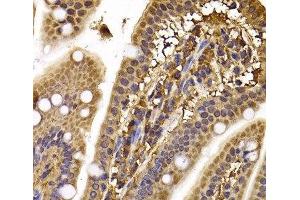 Immunohistochemistry of paraffin-embedded Mouse ileum using CLASP1 Polyclonal Antibody at dilution of 1:100 (40x lens).