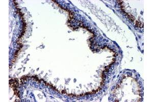 Image no. 2 for anti-Golgi Membrane Protein 1 (GOLM1) antibody (ABIN1498494) (GOLM1 antibody)