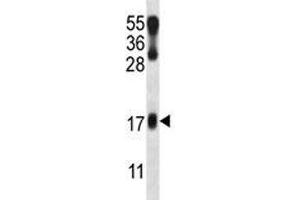 LMO2 antibody western blot analysis in NCI-H460 lysate. (LMO2 antibody  (AA 1-30))