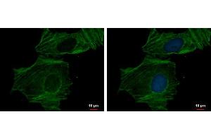 ICC/IF Image alpha Actin (cardiac muscle) antibody detects alpha Actin (cardiac muscle) protein at cytoskeleton by immunofluorescent analysis. (ACTC1 antibody)