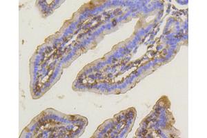 Immunohistochemistry (IHC) image for anti-Protein Kinase C, alpha (PKCa) antibody (ABIN4904772)