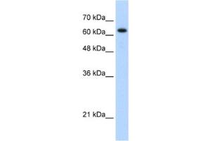 Western Blotting (WB) image for anti-RAD17 (RAD17) antibody (ABIN2460182) (RAD17 antibody)
