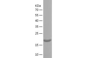 Western Blotting (WB) image for Collagen, Type XV, alpha 1 (COL15A1) (AA 1212-1388) protein (His tag) (ABIN7283991) (COL15A1 Protein (AA 1212-1388) (His tag))