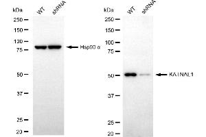 Western blotting analysis using KATNAL1 antibody (ABIN7799159).