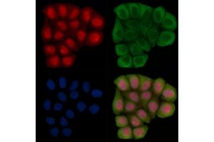 Phospho-Hsp90 alpha (Thr5/Thr7) Antibody staining Hela cells(45 min of heat-shock treatment) by IF/ICC.