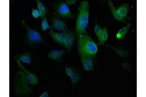 Immunofluorescence staining of U251 cells with ABIN7139779 at 1:100, counter-stained with DAPI. (COL1A1 antibody  (AA 1306-1323))