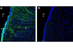 Expression of GPR142 in rat ventromedial hypothalamus. (G Protein-Coupled Receptor 142 (GPR142) Peptide)