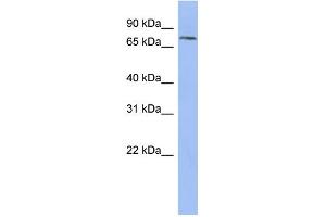 WB Suggested Anti-PNN Antibody Titration: 0. (PNN antibody  (N-Term))
