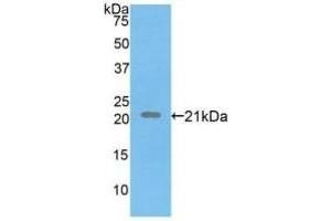 Detection of Recombinant FBN1, Human using Polyclonal Antibody to Fibrillin 1 (FBN1) (Fibrillin 1 antibody  (AA 723-902))