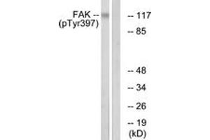 Western blot analysis of extracts from Jurkat cells treated with Ca2+ 40nM 30', using FAK (Phospho-Tyr397) Antibody.