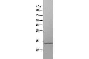 Western Blotting (WB) image for Small Nuclear Ribonucleoprotein D2 Polypeptide 16.5kDa (SNRPD2) (AA 1-118) protein (His tag) (ABIN7286700) (SNRPD2 Protein (AA 1-118) (His tag))