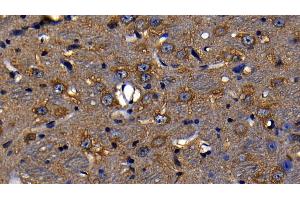 Immunohistochemistry (IHC) image for anti-Lymphocyte Antigen 96 (LY96) (AA 16-160) antibody (ABIN7437365)