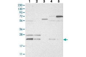Western blot analysis of Lane 1: RT-4, Lane 2: U-251 MG, Lane 3: Human Plasma, Lane 4: Liver, Lane 5: Tonsil with HINT3 polyclonal antibody  at 1:250-1:500 dilution.