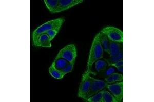 Immunofluorescence analysis of MCF-7 cells using RELB mouse mAb (green). (RELB antibody  (AA 273-443))