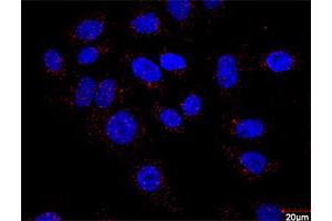 Proximity Ligation Analysis of protein-protein interactions between HSPB1 and F13A1. (F13A1 antibody  (AA 1-732))