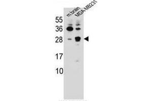 CBLN2 Antibody (C-term) western blot analysis in mouse brain tissue and MDA-MB231 cell line lysates (35ug/lane). (CBLN2 antibody  (C-Term))
